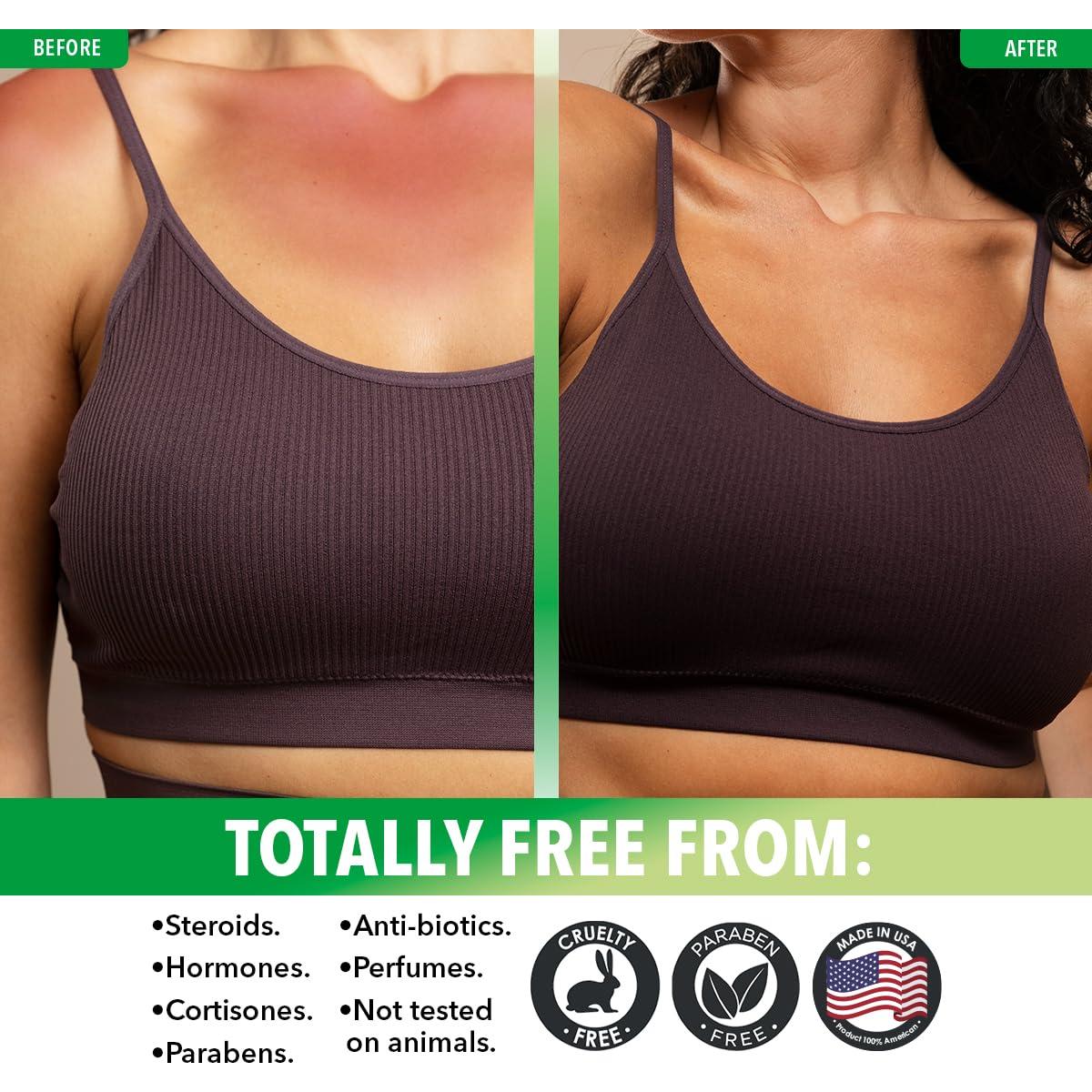 Gel de Aloe Vera Natural Dr. Robaina 340 g - Hidratante y Calmante