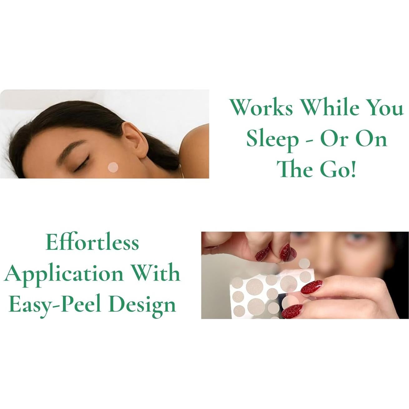 Parche para Acné Mega Patch Aloe Vera 108 unidades 8x12mm