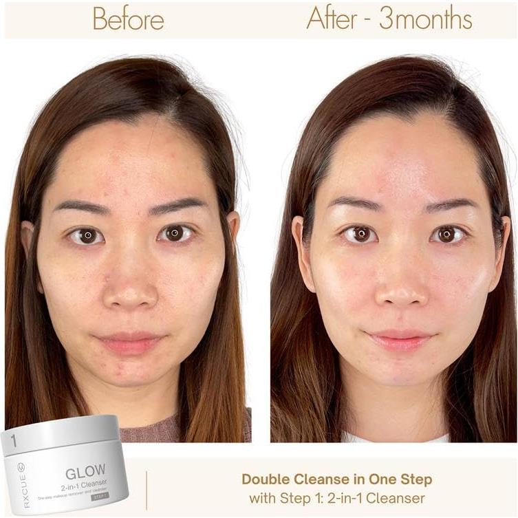 Kit de Cuidado de la Piel Mini Rxcue 3 Pasos Viaje 240g