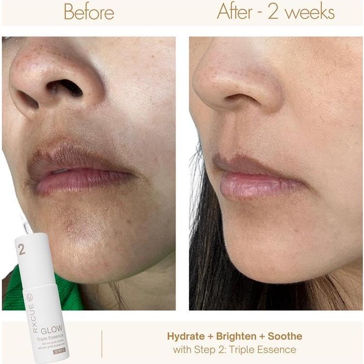 Kit de Cuidado de la Piel Mini Rxcue 3 Pasos Viaje 240g