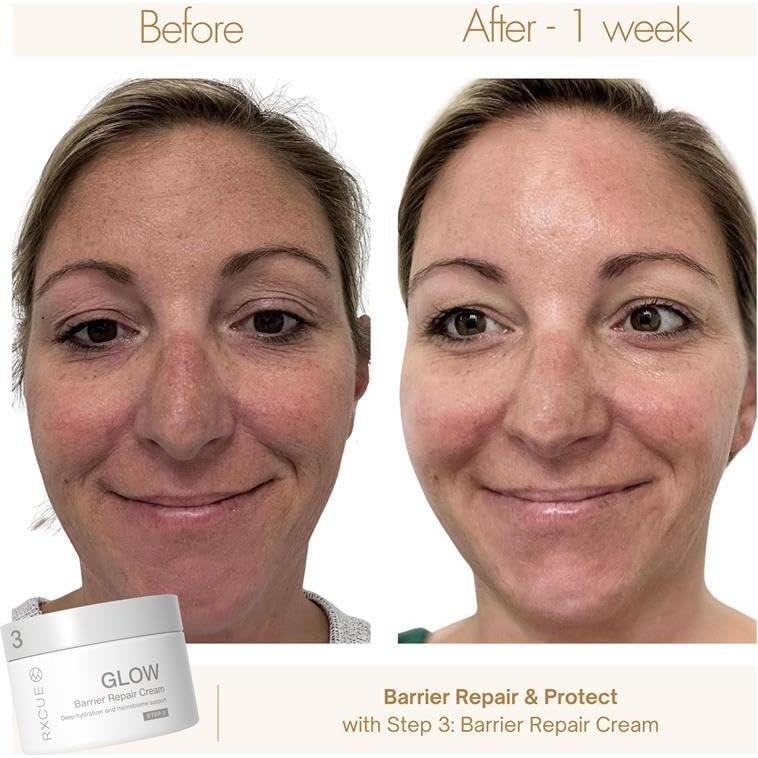 Kit de Cuidado de la Piel Mini Rxcue 3 Pasos Viaje 240g