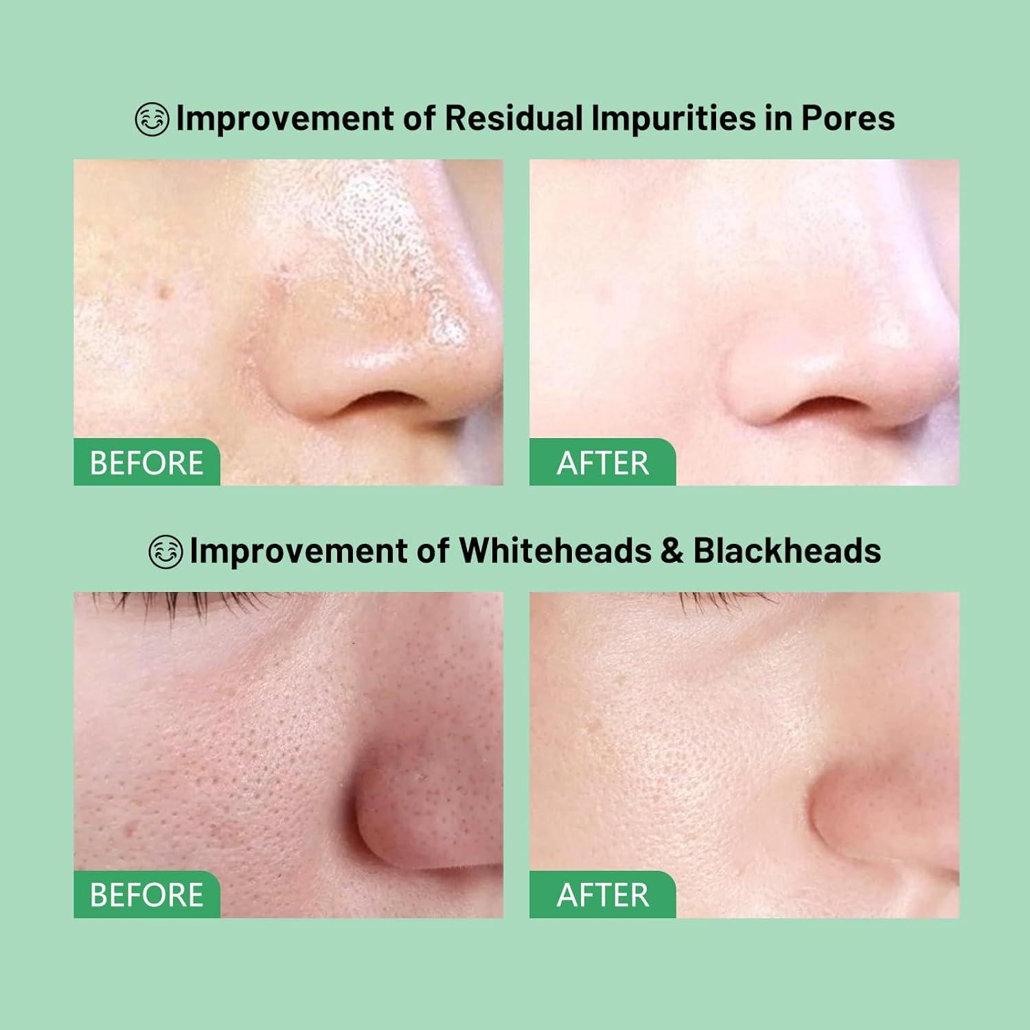 Mascarilla de Arcilla Tomate Verde 100g - Control Sebo y Poros