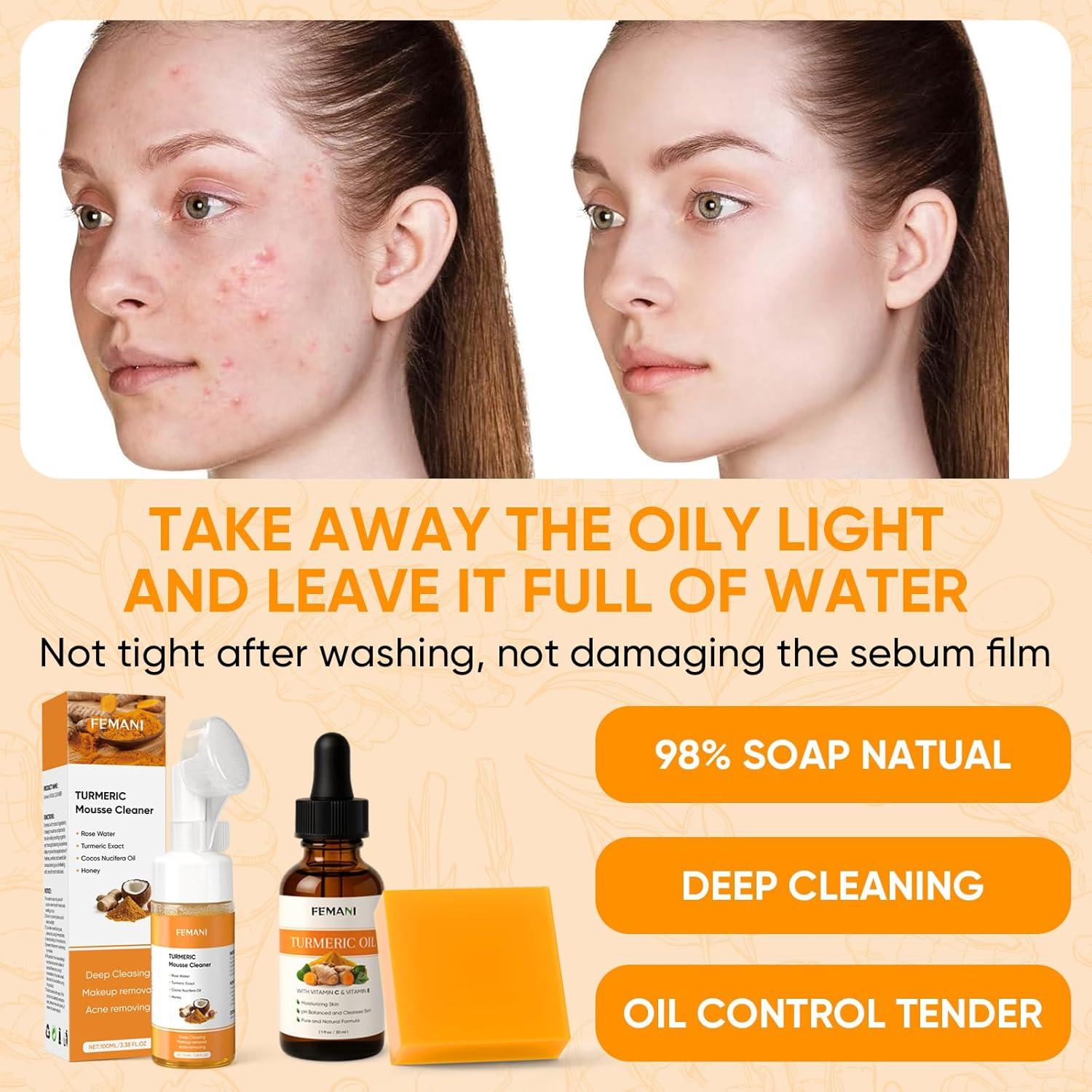 Juego de Cuidado Facial de Cúrcuma Femeni - Jabón y Aceite