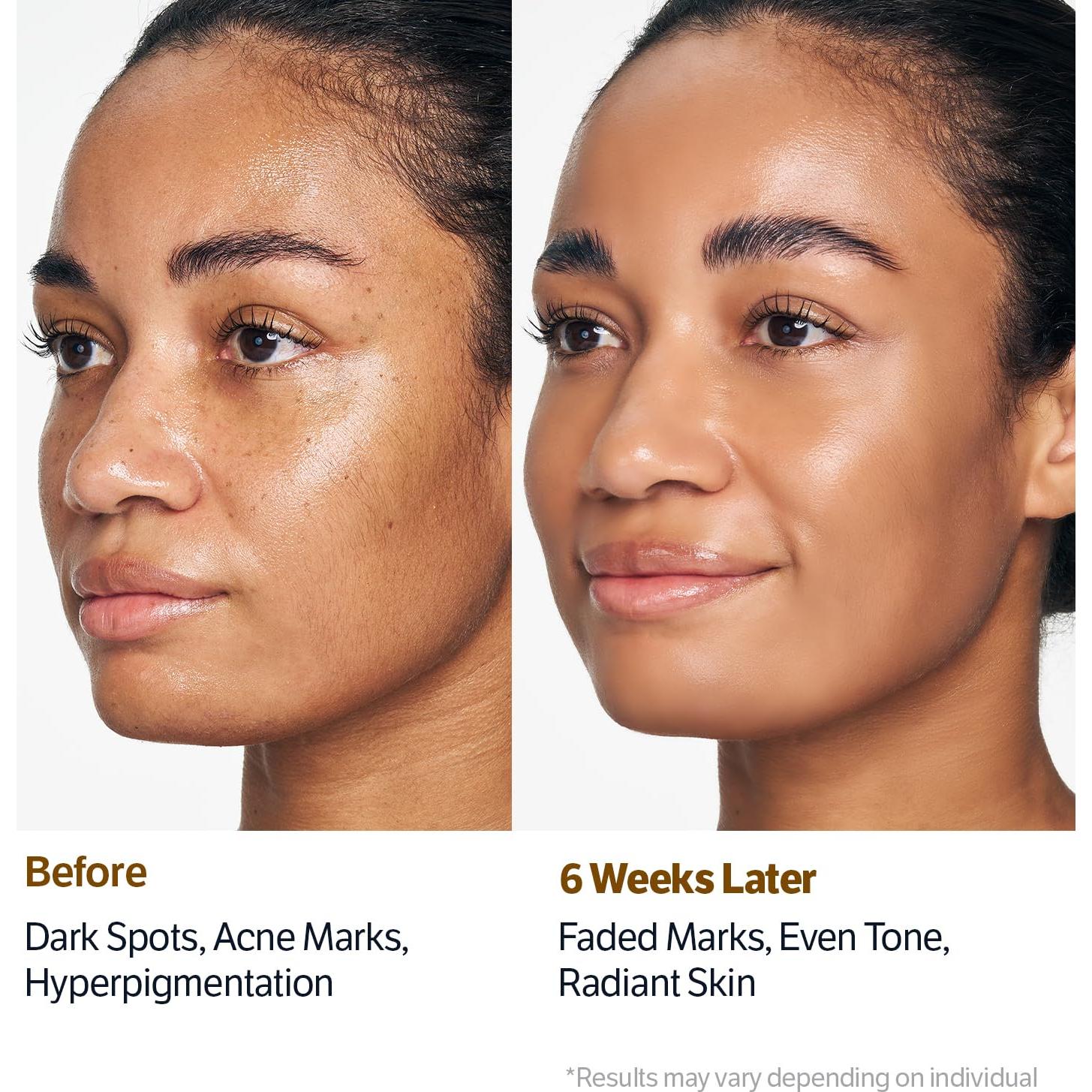 Limpiador Facial Gel Kojico y Niacinamida SUNGBOON 140g