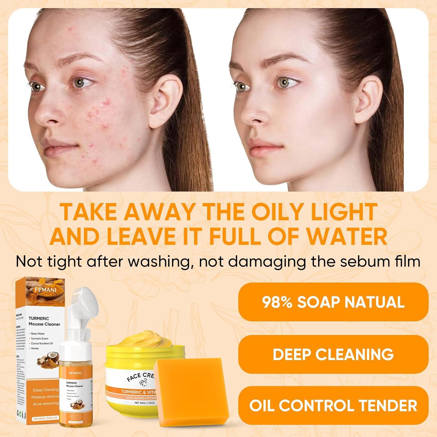 Juego de Cuidado Facial de Cúrcuma Femani - Jabón, Crema y Limpiador