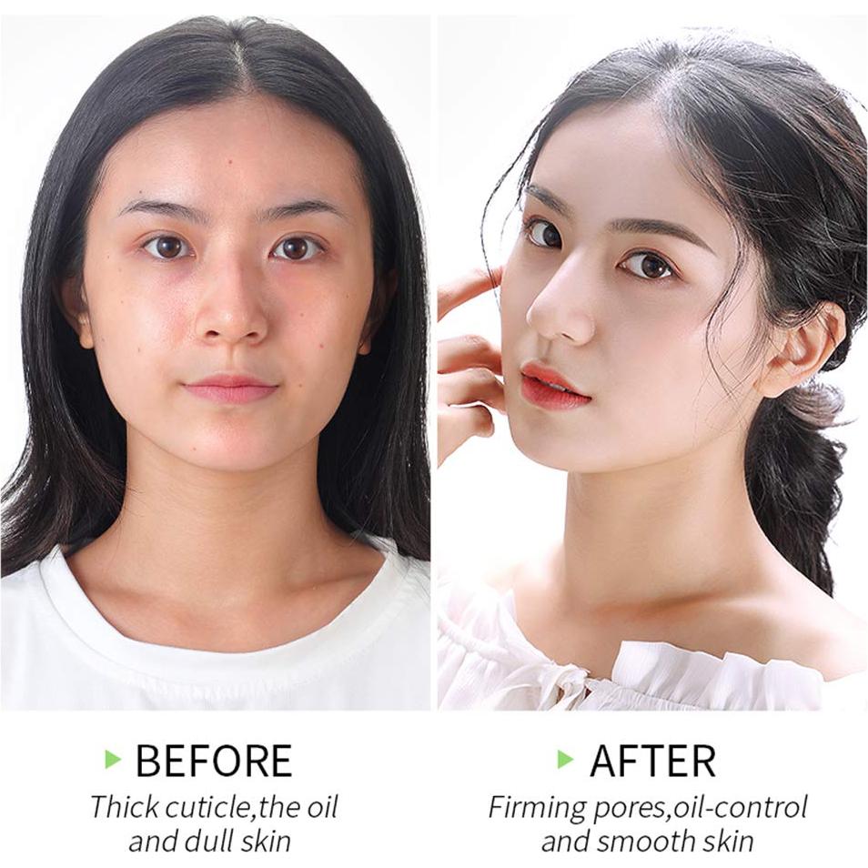 Gel Exfoliante Facial de Matcha MIESCHER - Hidratante Natural 60g