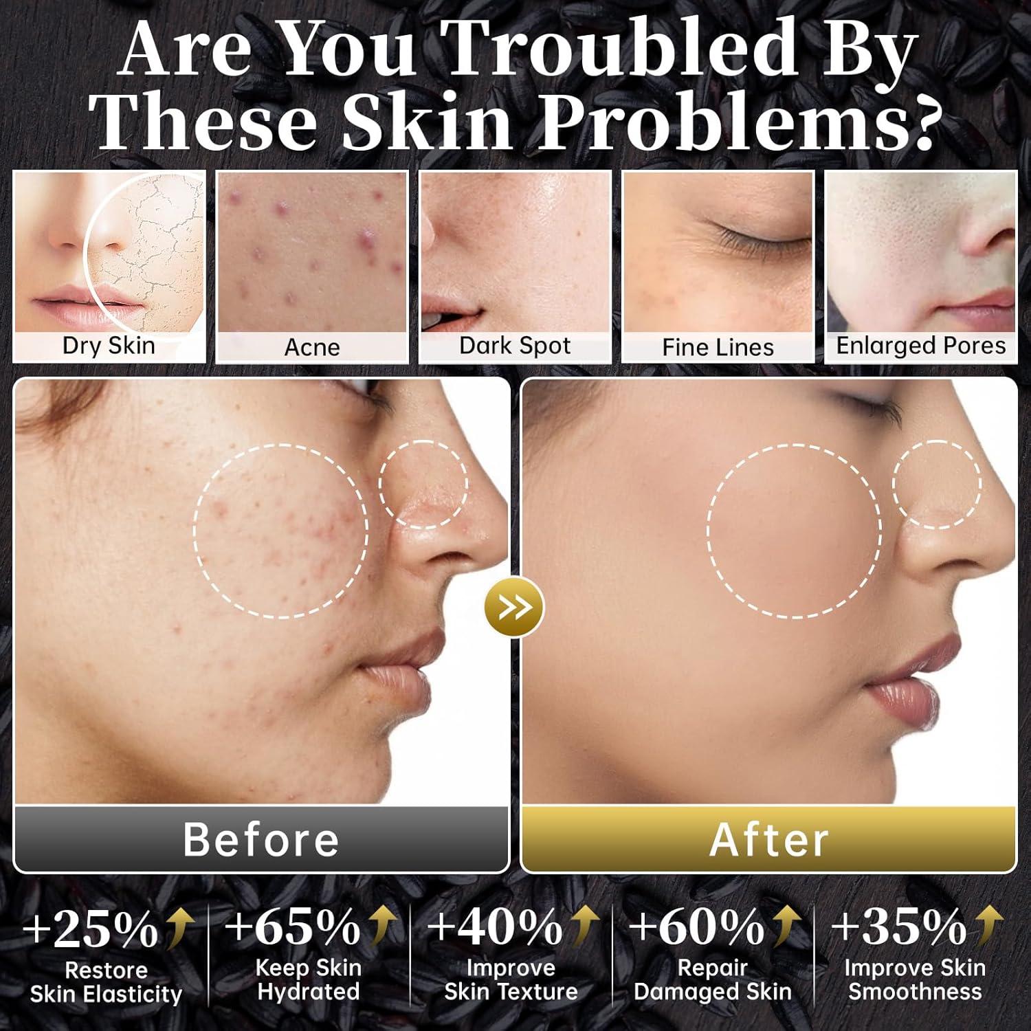 Conjunto de Cuidado de la Piel MIZEEYE 6 PZS Antienvejecimiento