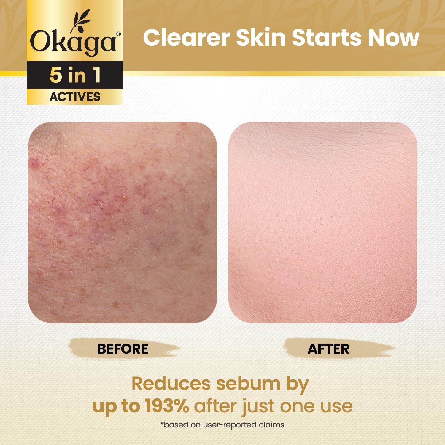 Ampoule Exfoliante de Arroz Okaga 90 mL - Piel Suave y Brillante