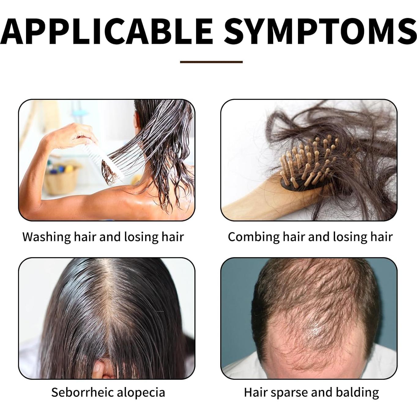 Suero de Crecimiento Capilar Lucksun 30ml - Aceite de Sésamo Negro