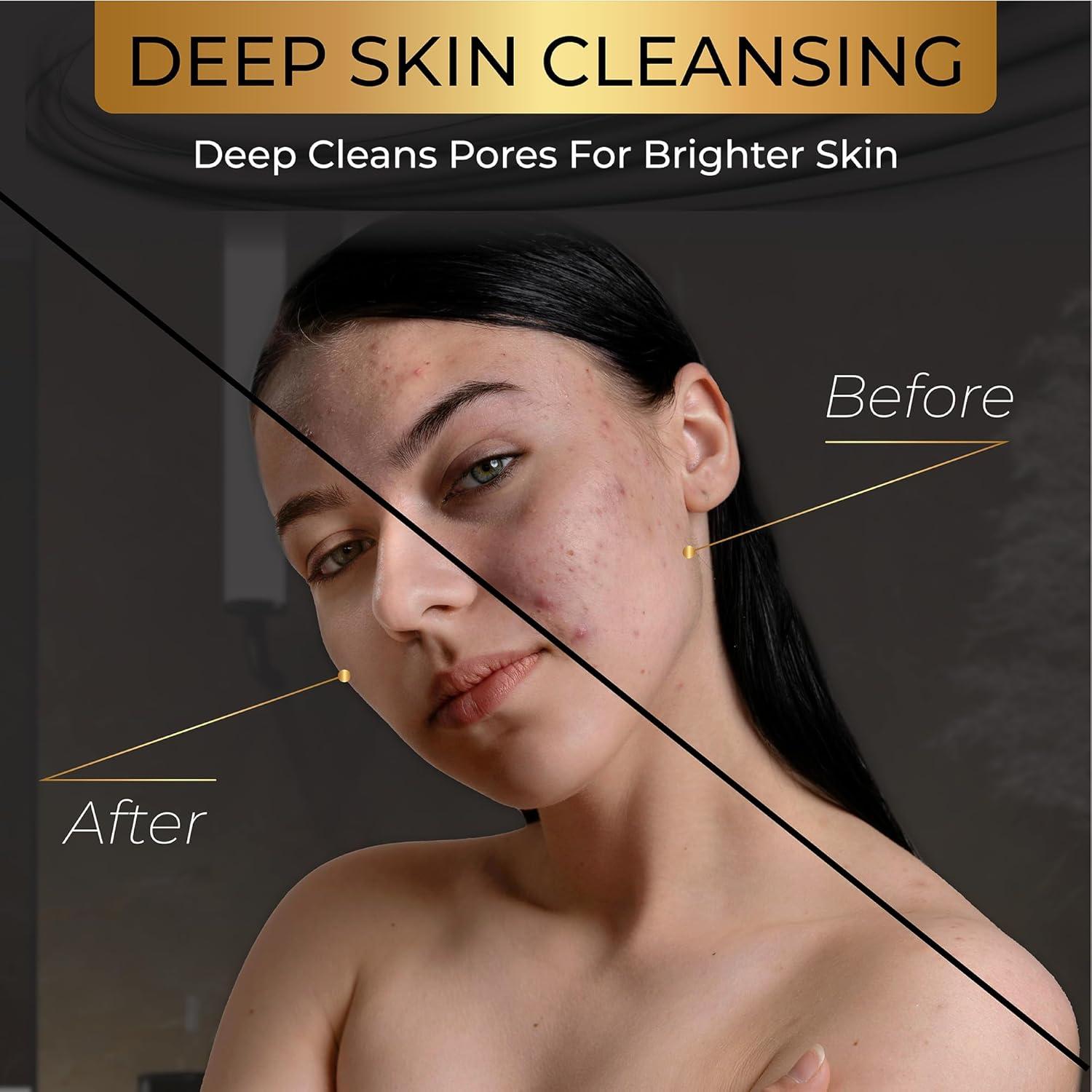 Conjunto de Jabones de Carbón Natural AMVital - 3 Piezas Veganas