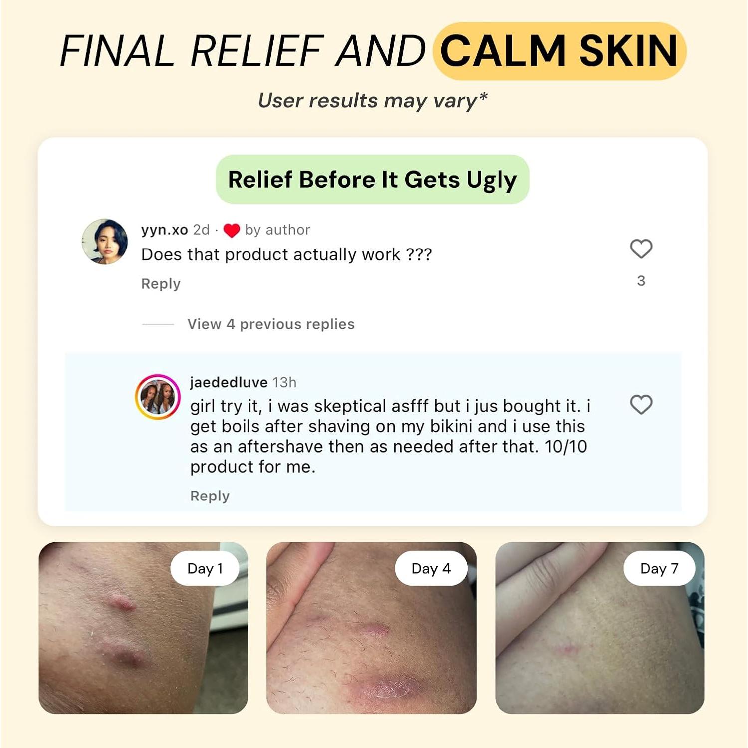 Ungüento Cuidado Flare 2x28.35g - Alivio para Acné y Bultos