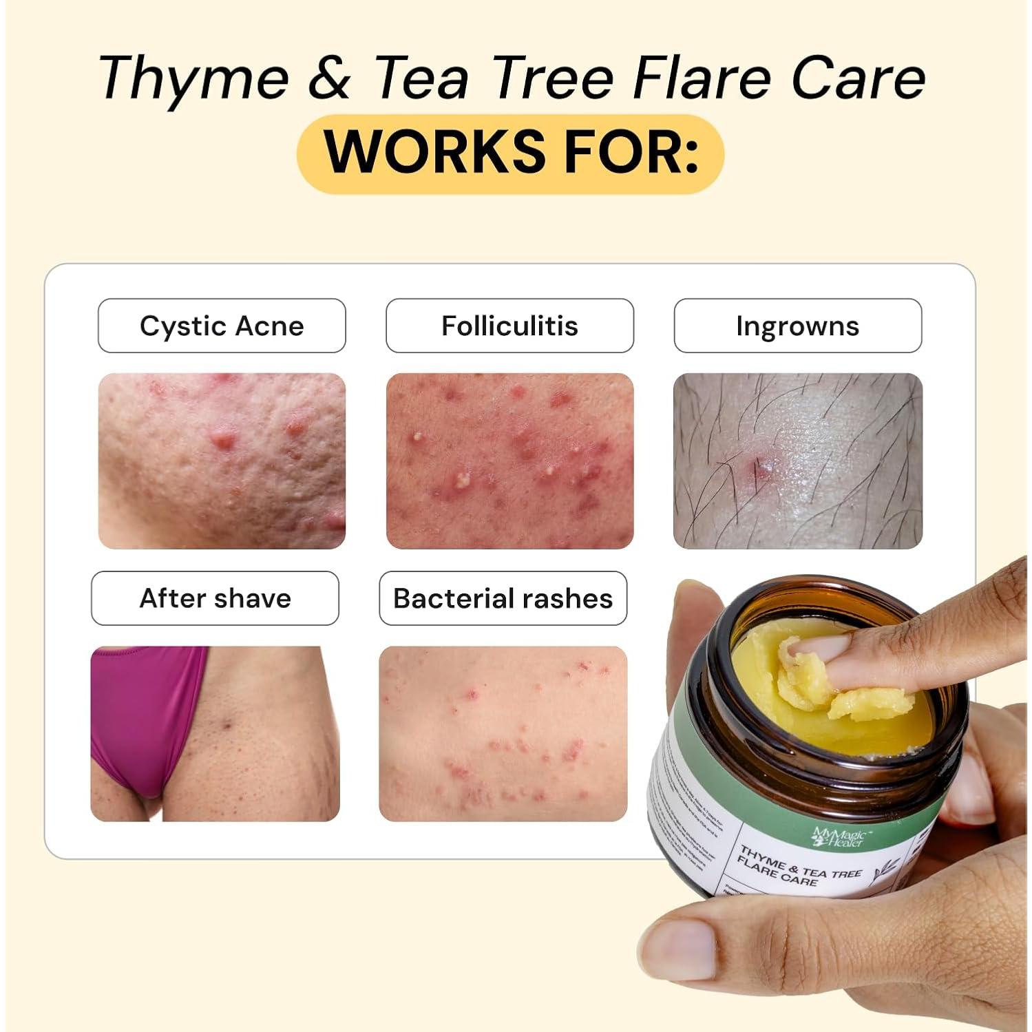 Ungüento Cuidado Flare 2x28.35g - Alivio para Acné y Bultos