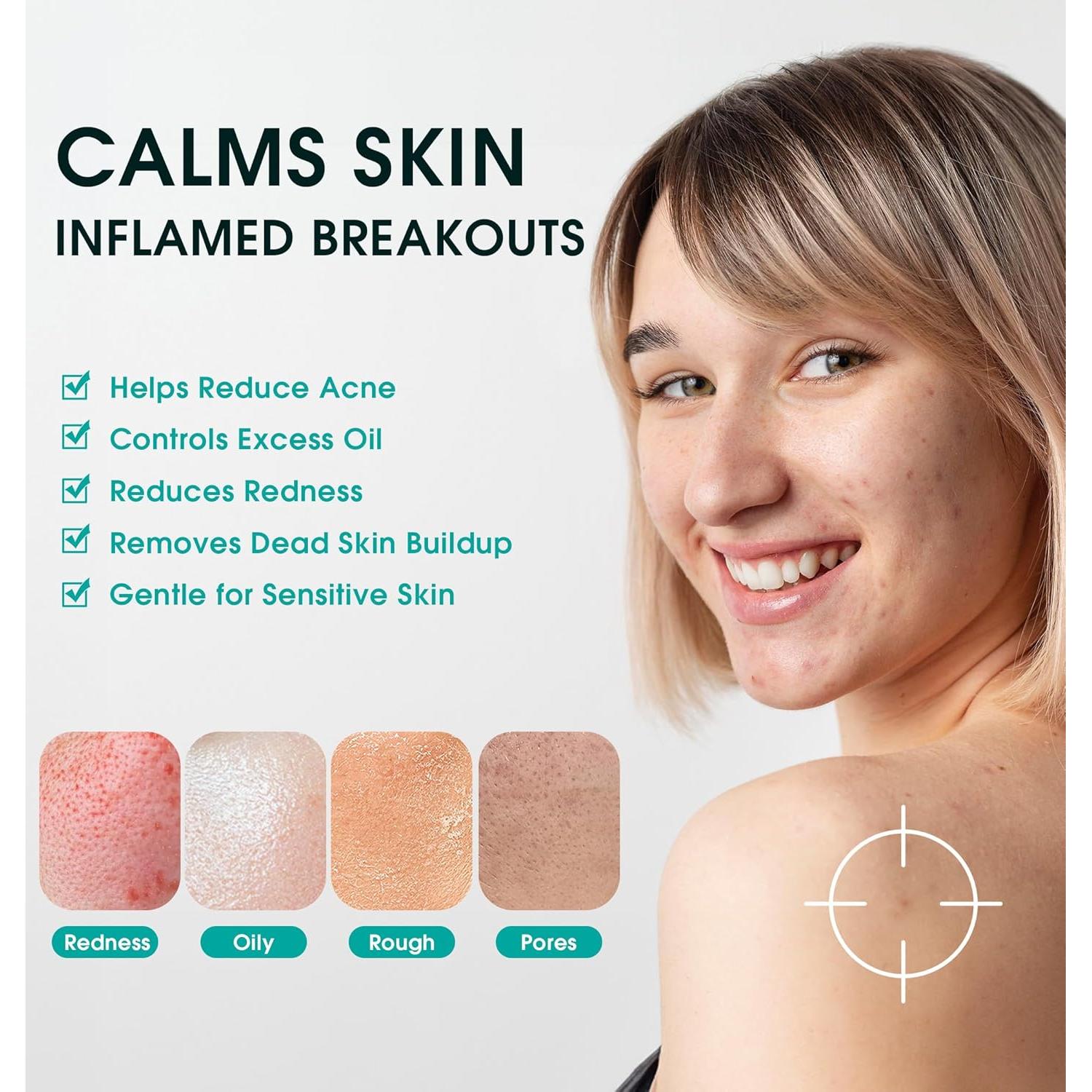 Toallitas Limpiadoras Faciales ProCIV 28PCS - Ácido Salicílico