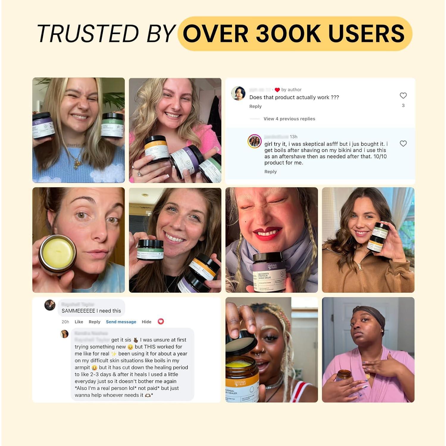 MyMagicHealer Cuidado de Erupciones 113.4 g - Foliculitis, Acné