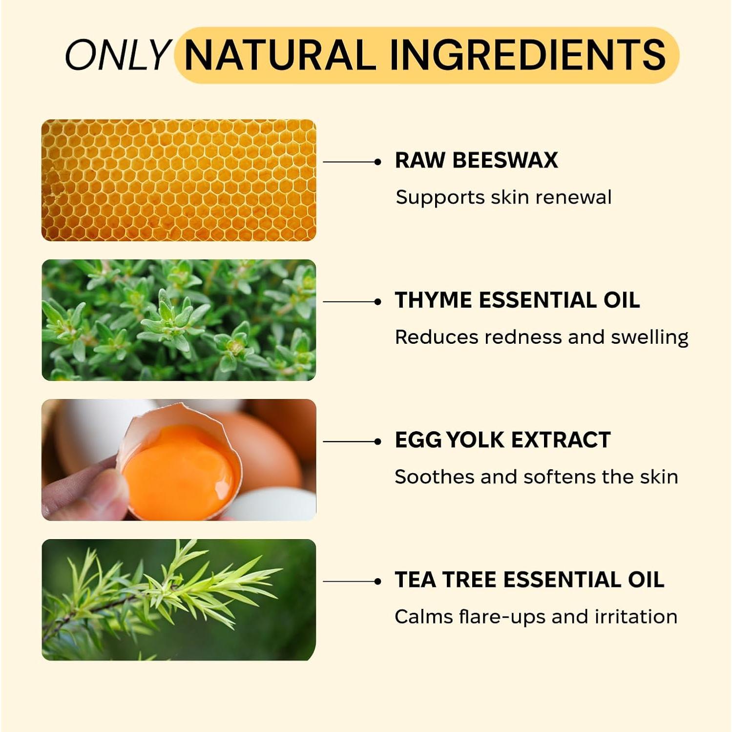 MyMagicHealer Cuidado de Erupciones 113.4 g - Foliculitis, Acné