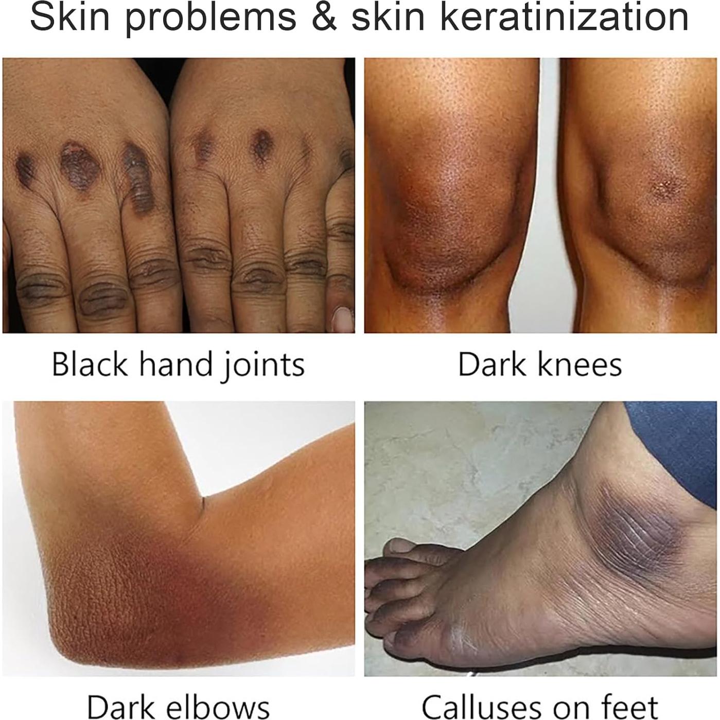 Aceite Exfoliante Amarillo HWM 100 ml - Peeling Químico Suave para Todo Tipo de Piel