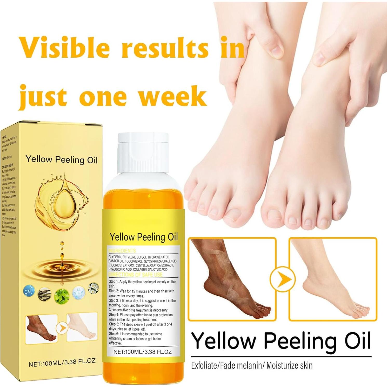 Aceite Exfoliante Amarillo HWM 100 ml - Peeling Químico Suave para Todo Tipo de Piel