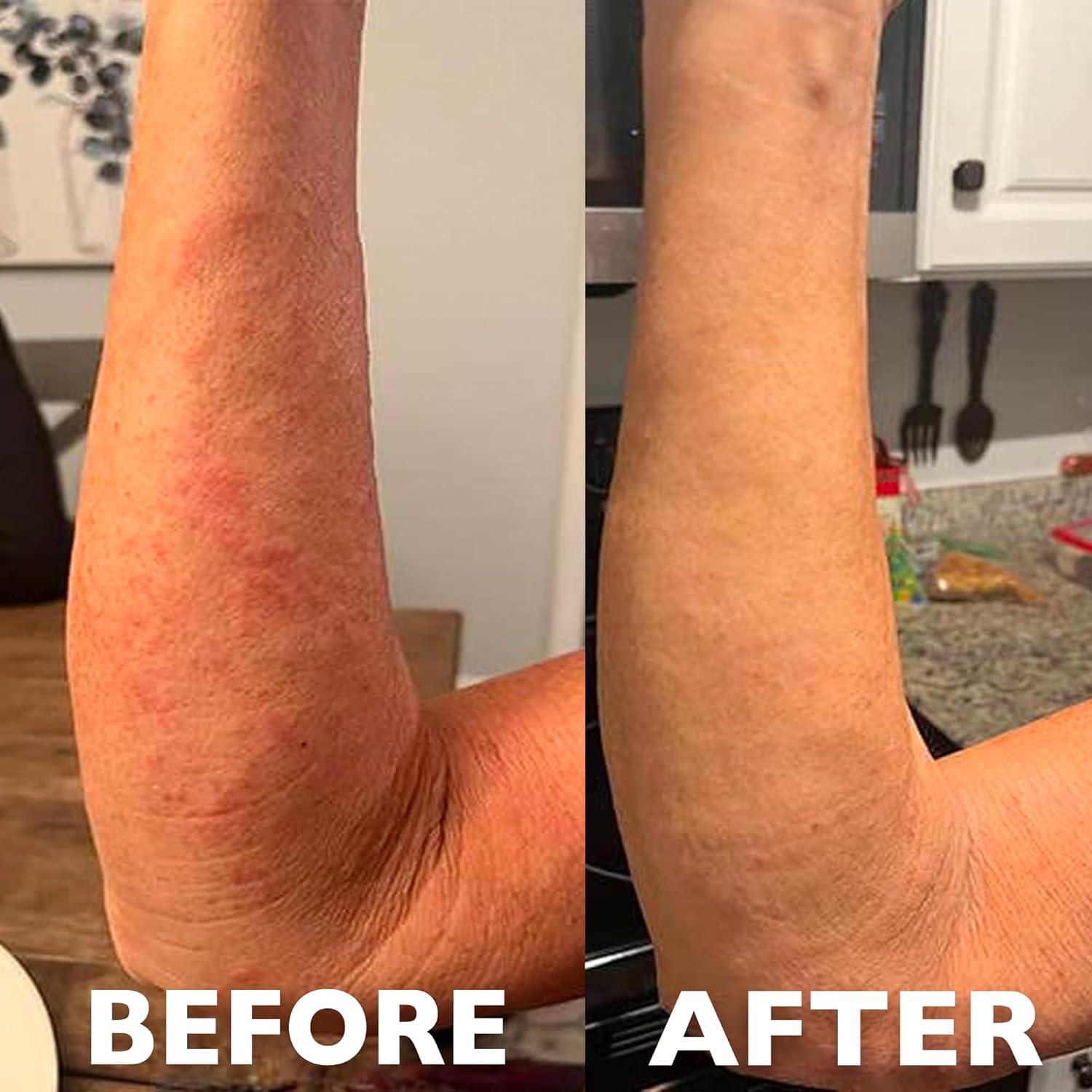 Hey Honey Ungüento Sanador Multifuncional 911 - 28.35 g