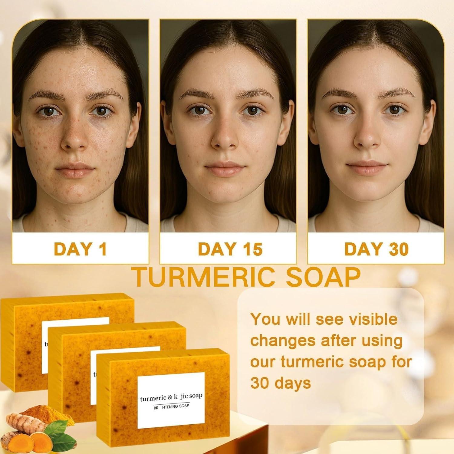 Jabón de Cúrcuma con Limón Weizhansushangmao - 3 Piezas