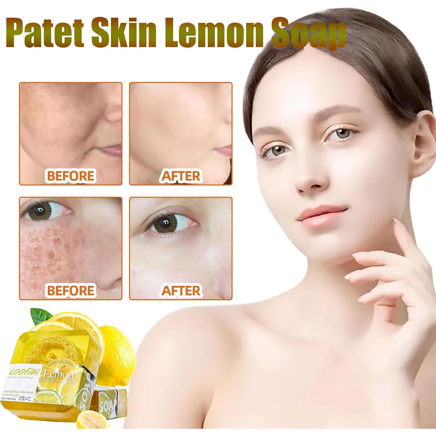 Jabón Patet Skin de Limón 108g - Cuidado de Piel Hiperpigmentación
