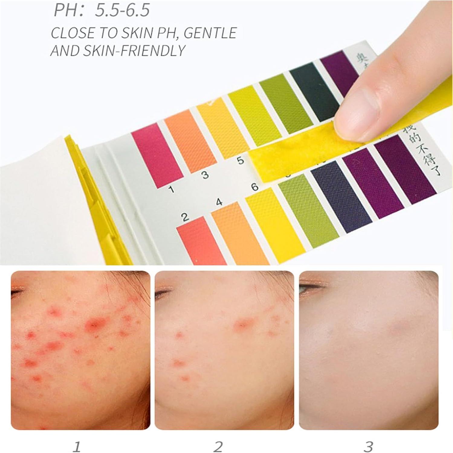 Jabón Patet Skin de Limón 108g - Cuidado de Piel Hiperpigmentación