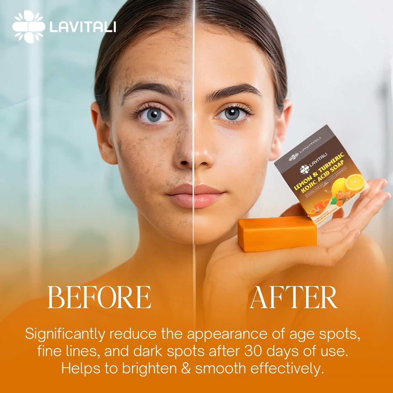 Jabón Natural LaVitali 6 Piezas Ácido Kójico Limón Cúrcuma