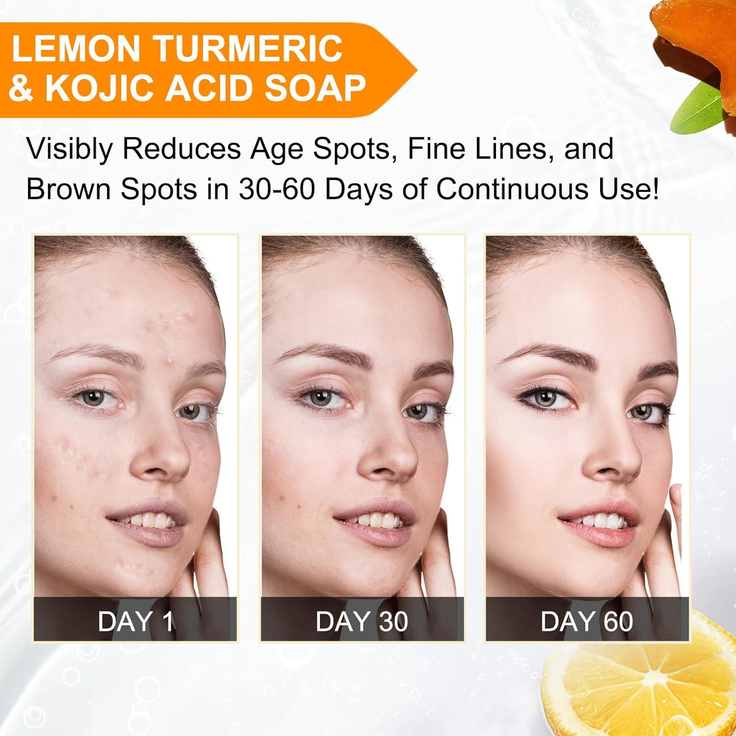 Jabón Orgánico Ácido Kójico con Cúrcuma y Limón 198g