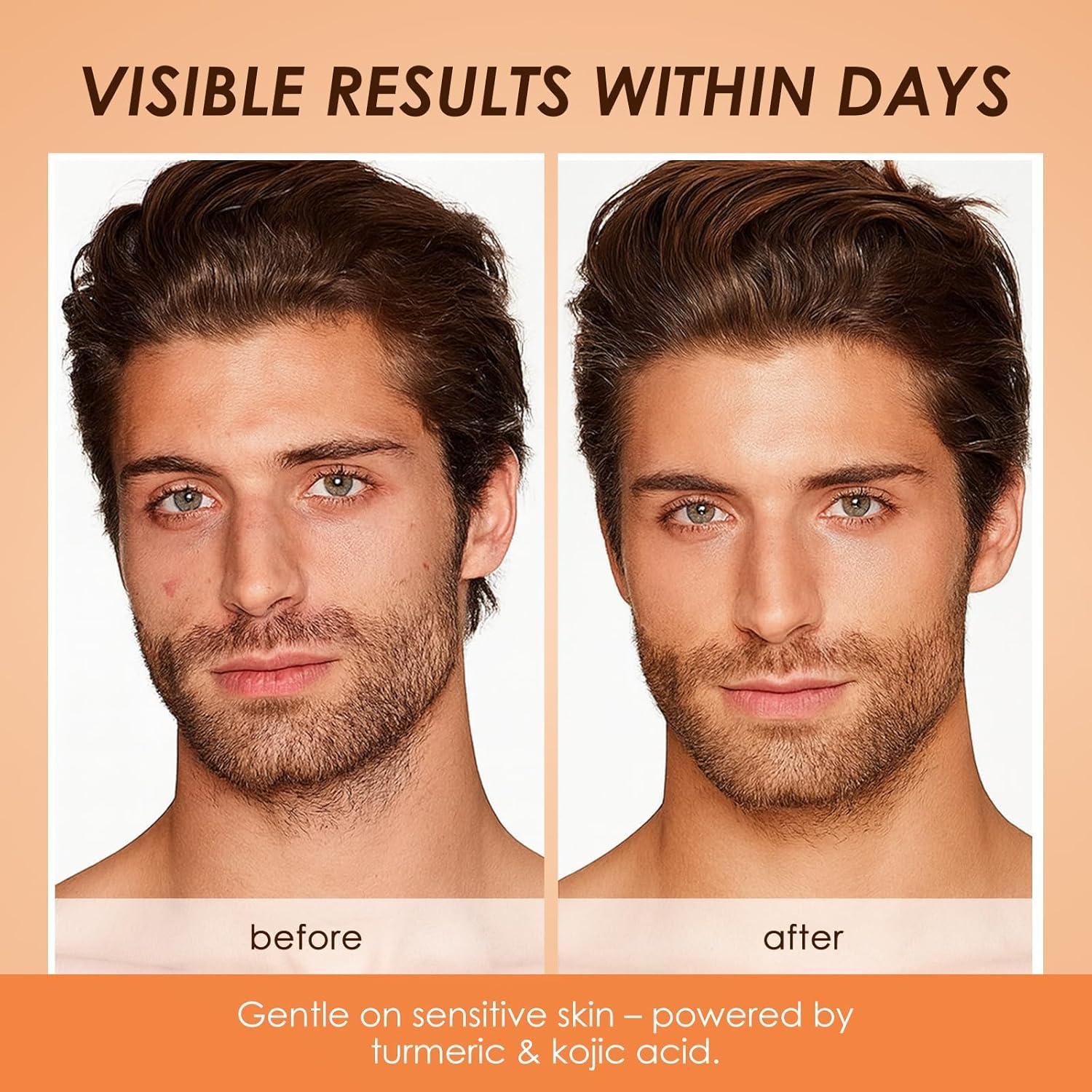 Jabón Aclarador Íntimo XPDGVS con Cúrcuma y Limón 200g