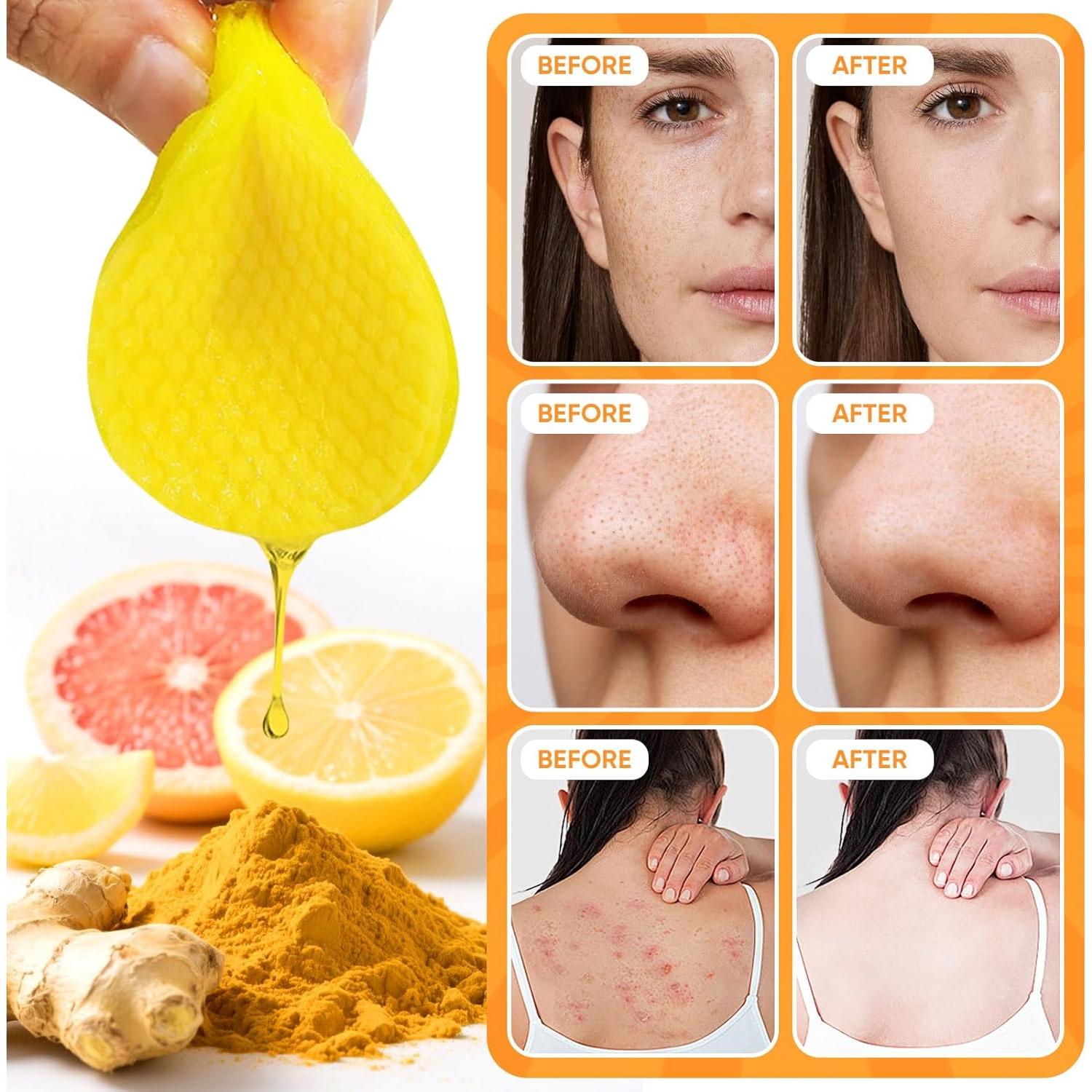 Set de Cuidado Facial de Cúrcuma 50 Discos + Jabón + Limpiador