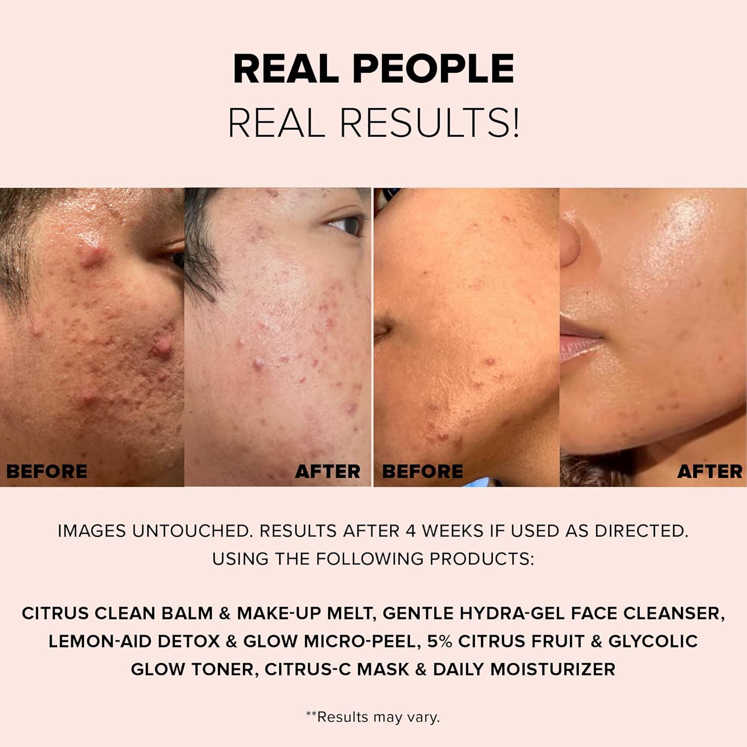 Nudestix Set de Renovación Cítrica para Maquillaje - Kit de Viaje