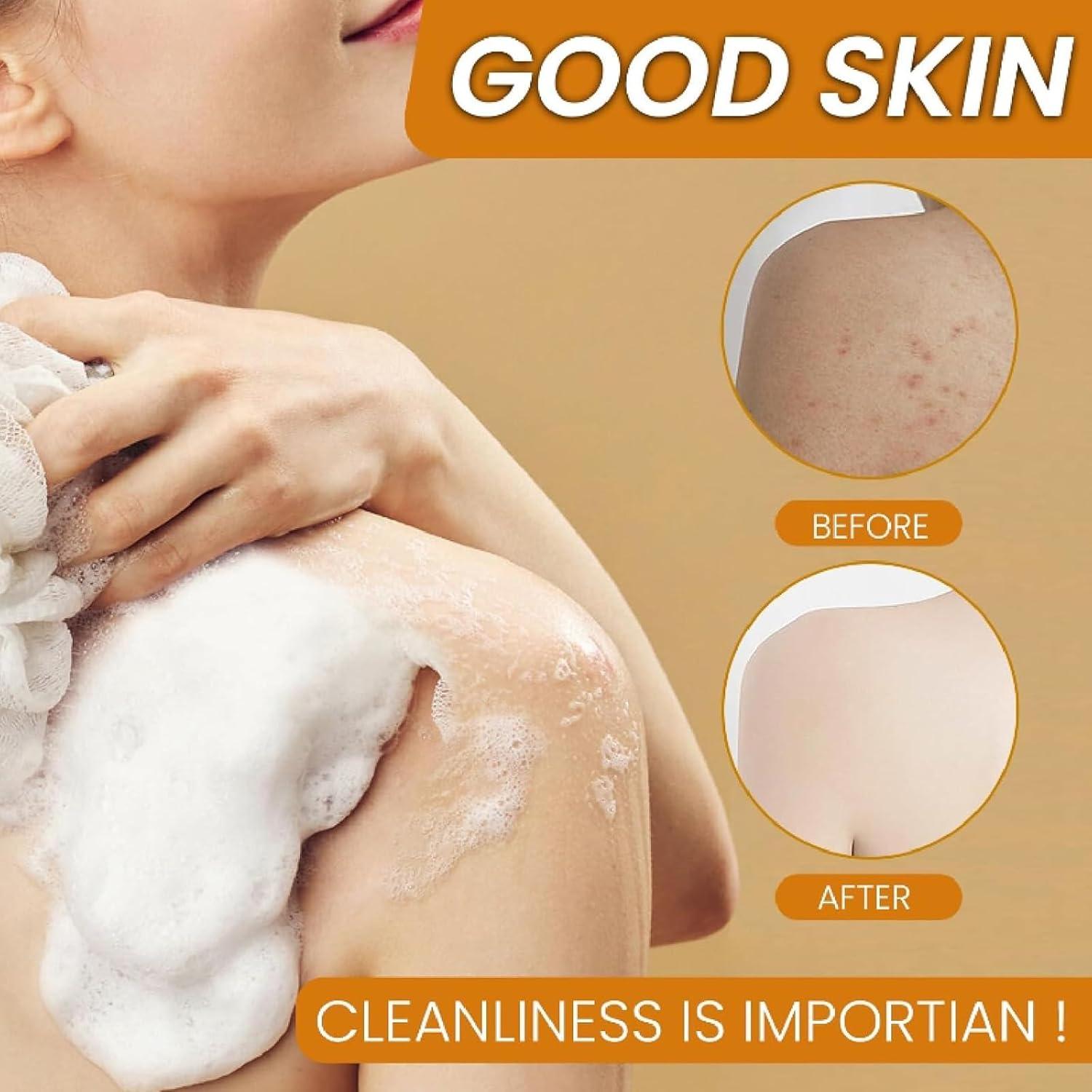 Jabón de Limón y Cúrcuma Kojic 100g - Hidratación y Limpieza