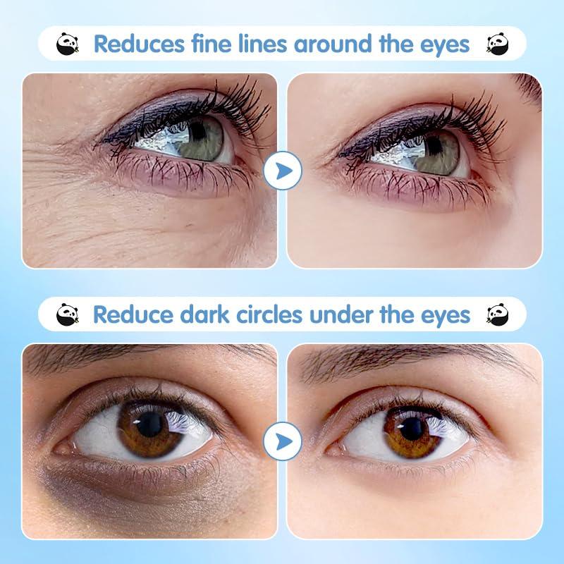 Parche Hidratante para Ojos Epstur - 60 Pares con Ácido Hialurónico