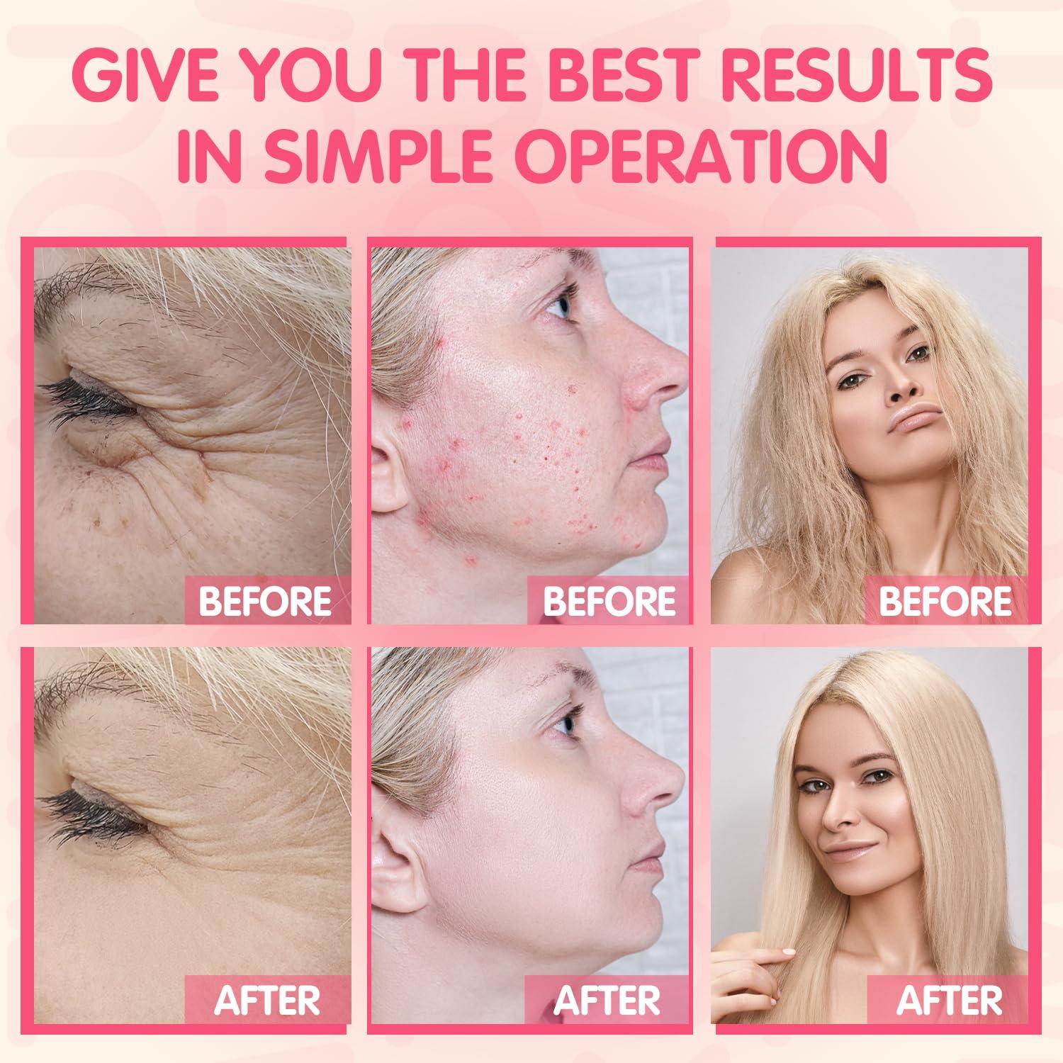 Máquina Facial de Alta Frecuencia TUMAKOU Naranja 4 Tubos