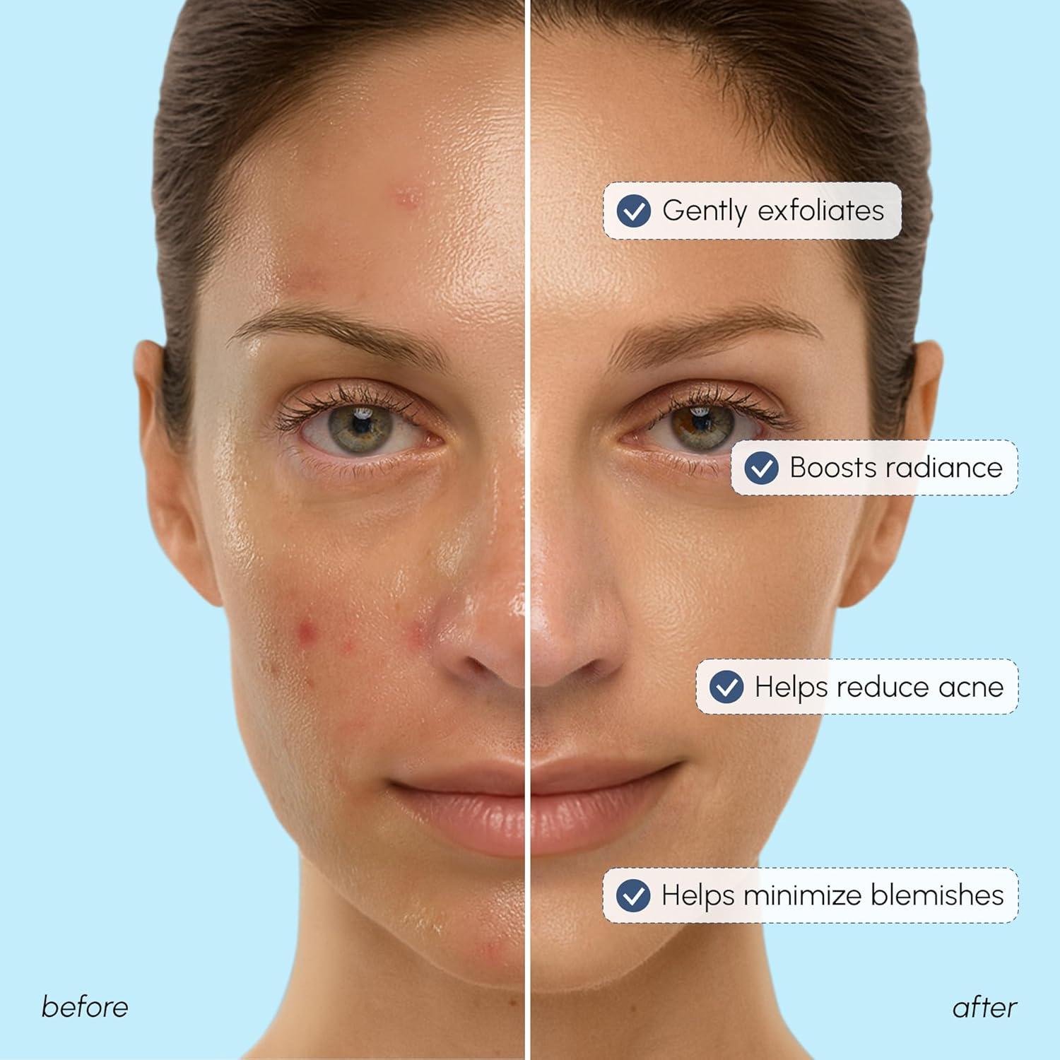 Tónico Exfoliante Facial MAREE 10% Ácido Glicólico 250ml