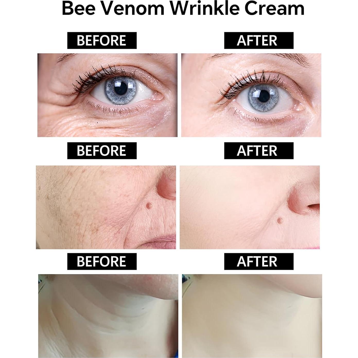 Crema Antienvejecimiento Skyoyo con Veneno de Abeja 91g