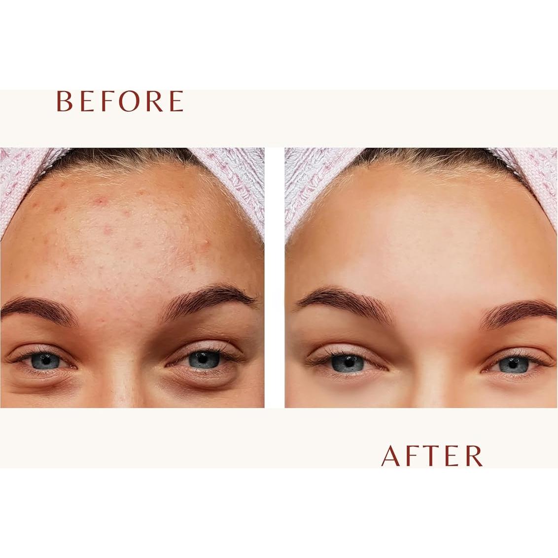 Peeling Facial SkinpHoria 30ml - AHA, PHA, BHA, Niacinamida