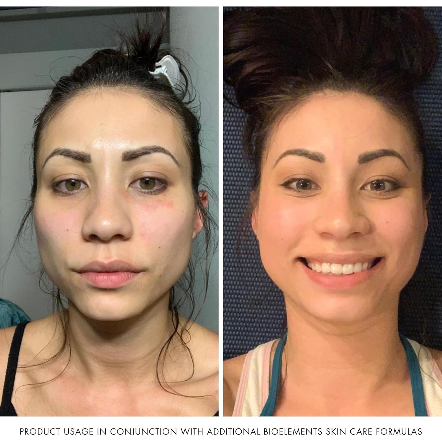 Limpiador Espumoso Bioelements 192.5 ml para Piel Mixta