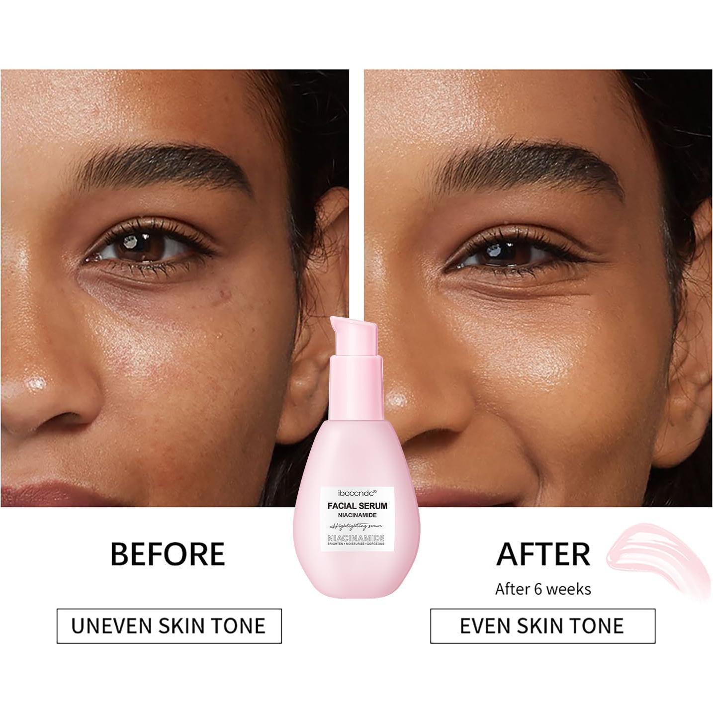 Suero Facial Hidratante WEEMAY 75ML Niacinamida Ácido Hialurónico