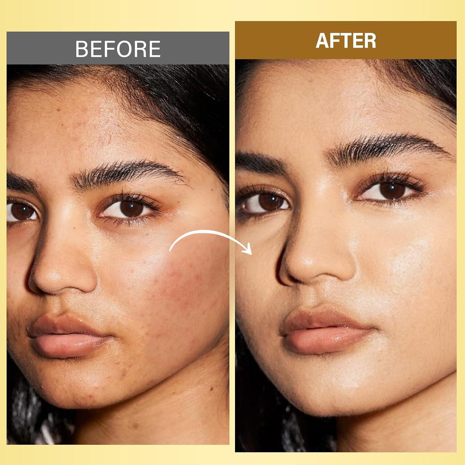 Aceite Facial Antienvejecimiento RIHAKO Cúrcuma y Rosa Mosqueta 181g