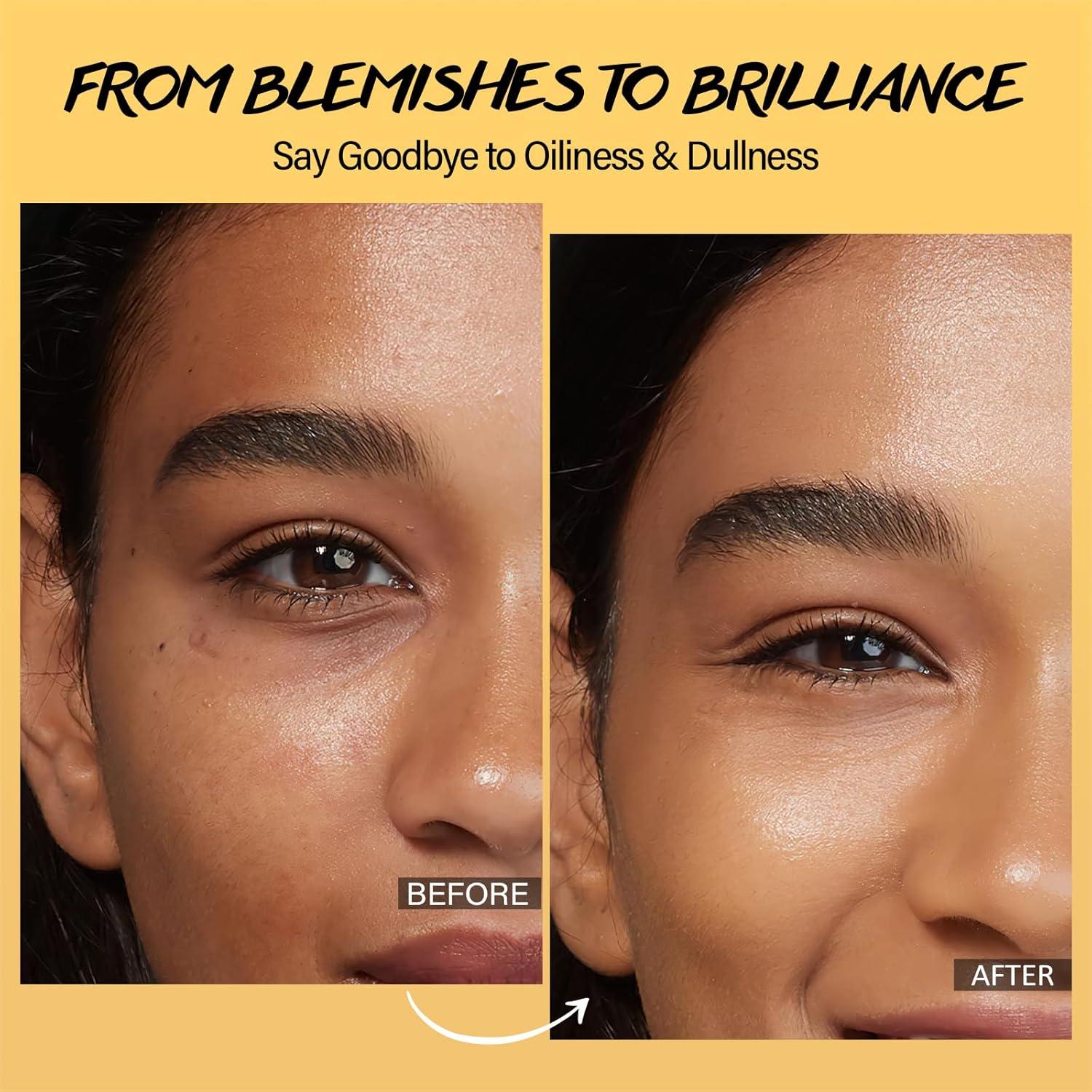 Discos Limpiadores Exfoliantes Kóji y Cúrcuma 60 Pcs