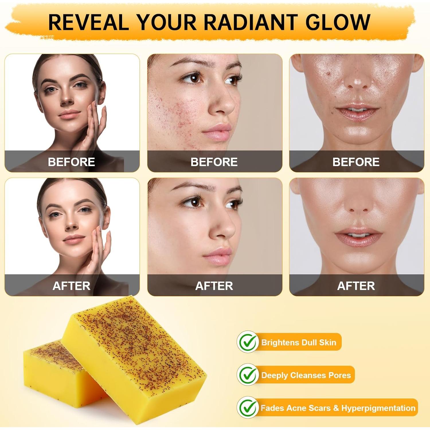 Jabón Ácido Kójico Urrznp 2 Barras 221g Limón y Cúrcuma