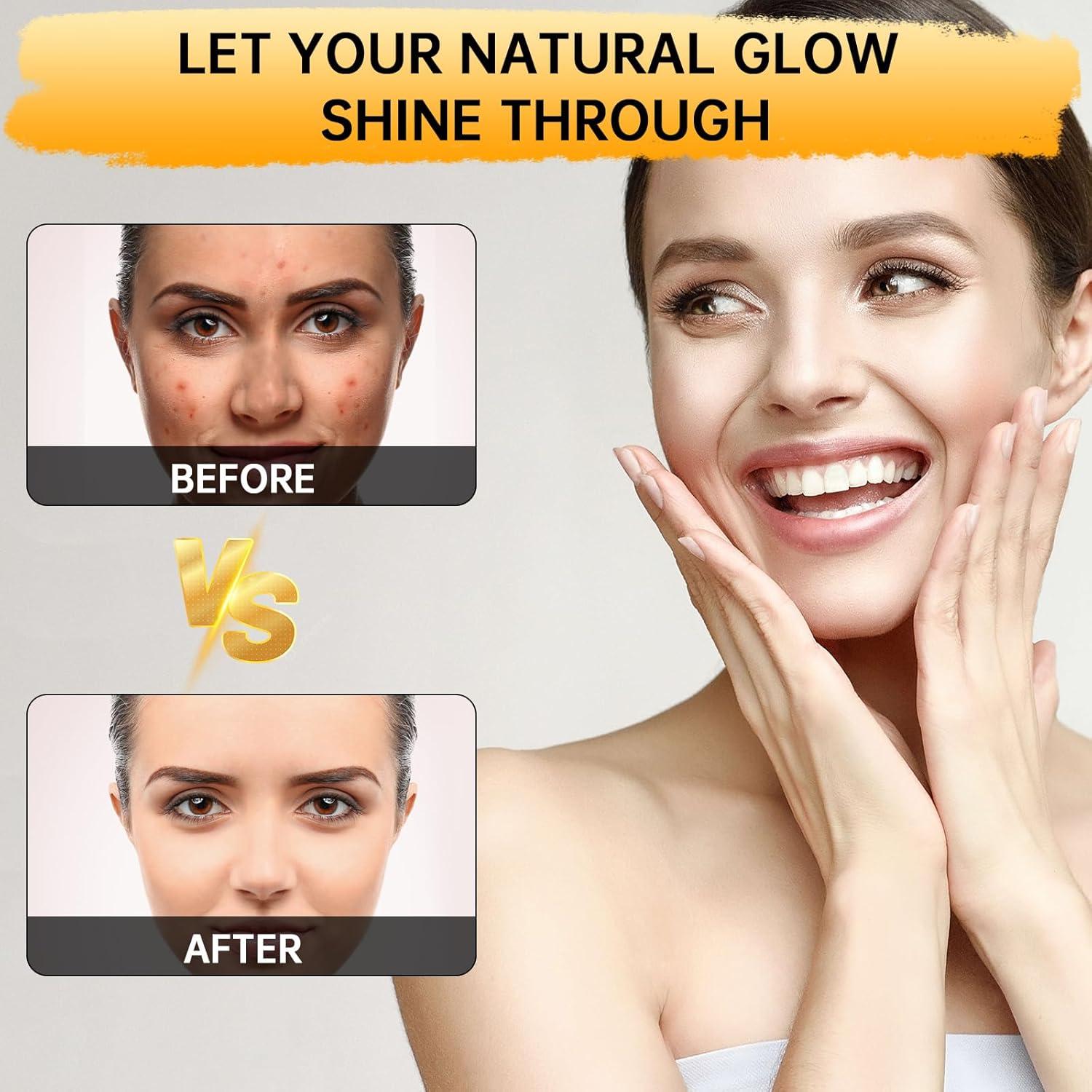 Jabón Ácido Kójico Urrznp 2 Barras 221g Limón y Cúrcuma