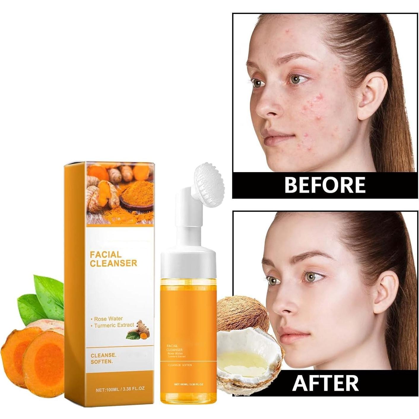 Limpiador Facial Espumoso de Cúrcuma EAEVDJ - 2 Pcs