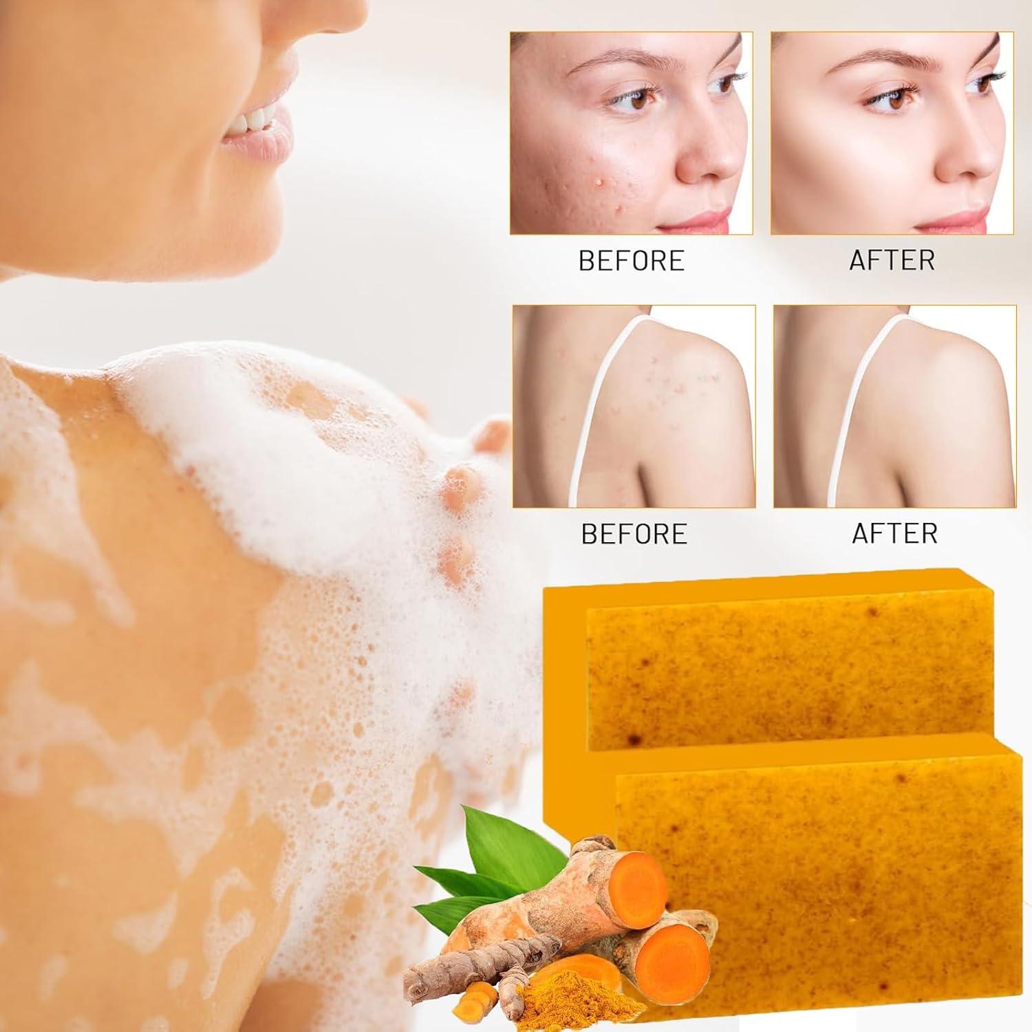 Juego de Cuidado Facial de Cúrcuma LuckNest - 4 Piezas