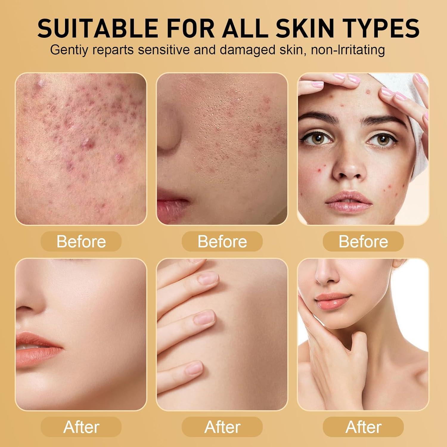 Gel de Cuidado de Piel Rubeonly con Aceite de Emú y Cúrcuma 50g