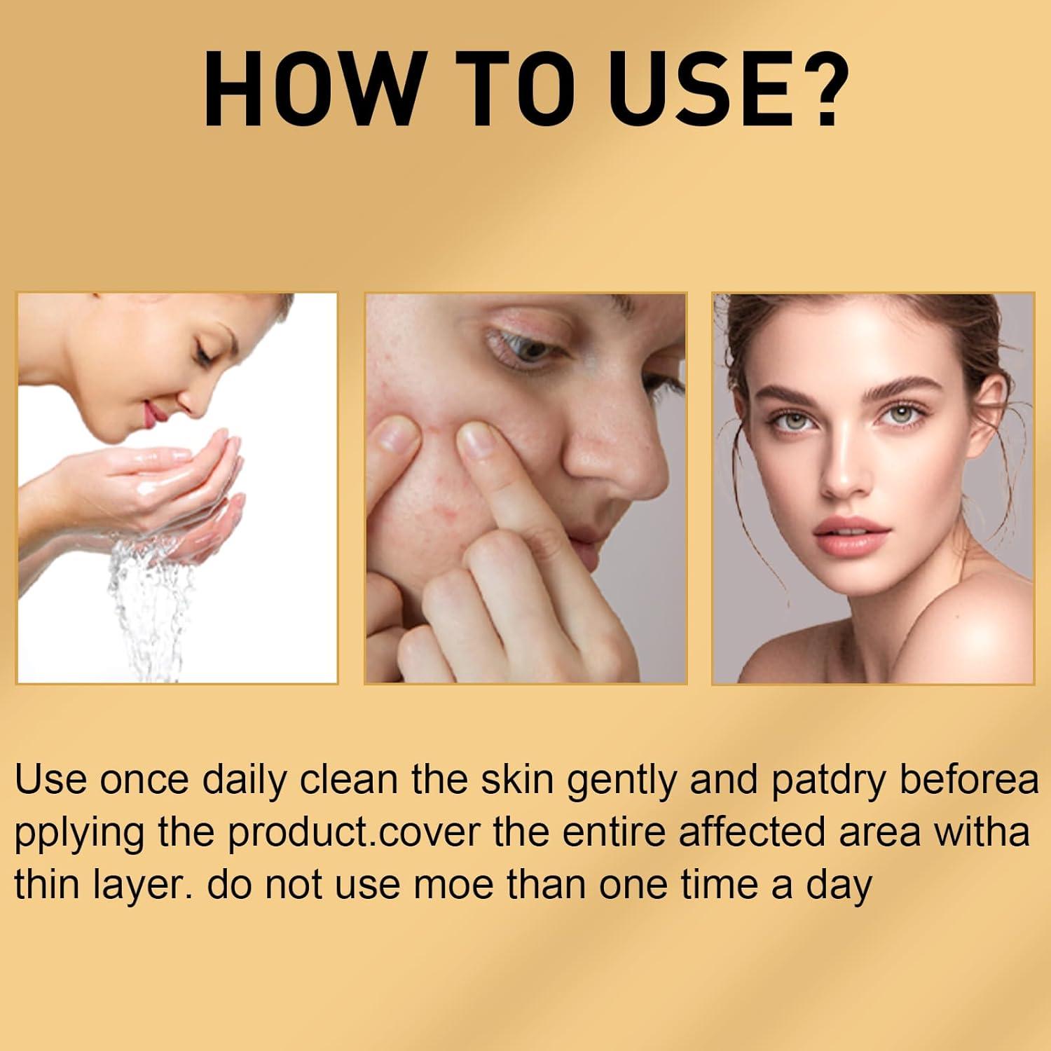 Gel de Cuidado de Piel Rubeonly con Aceite de Emú y Cúrcuma 50g