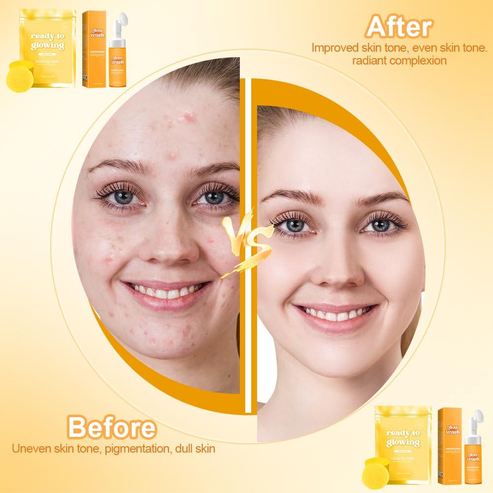 Set de Limpieza Facial SEILETOO: Lavado de Cúrcuma + 60 Almohadillas