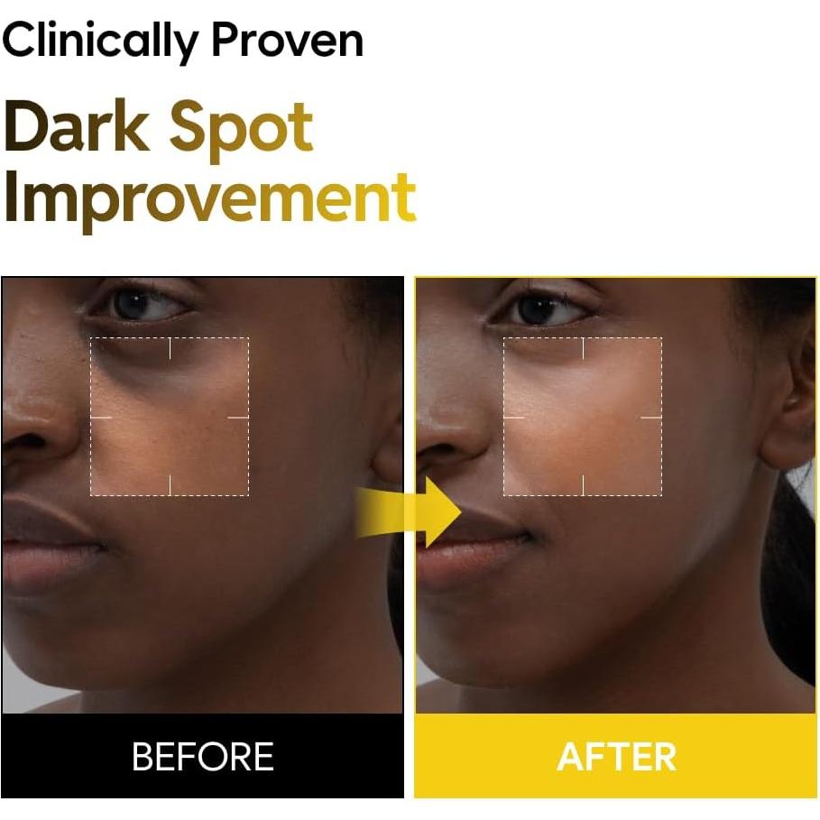 Tónico Lechoso 5% Niacinamida GREENCOS 200ml - Cuidado Piel