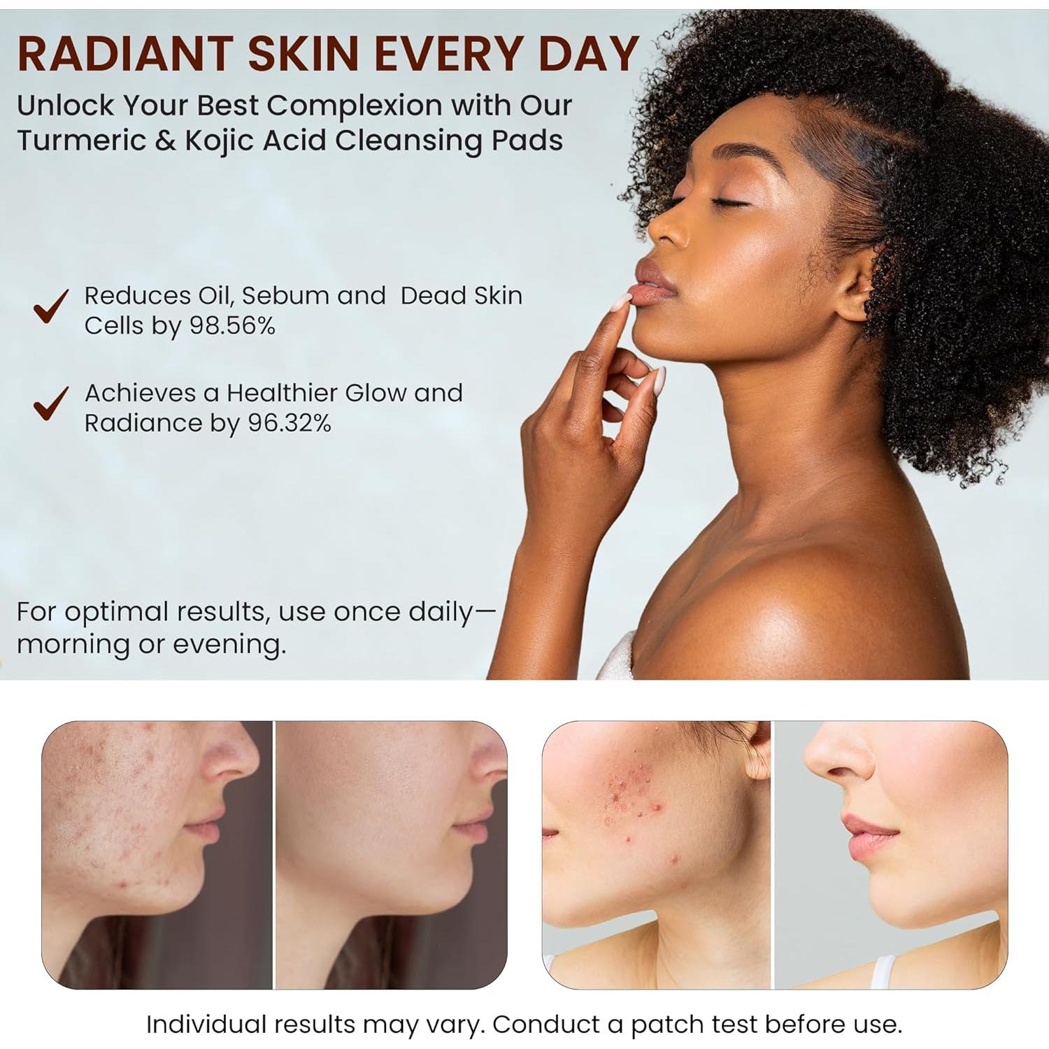 Almohadillas Limpiadoras Live Healthy Ácido Kojico y Cúrcuma 30 Unidades