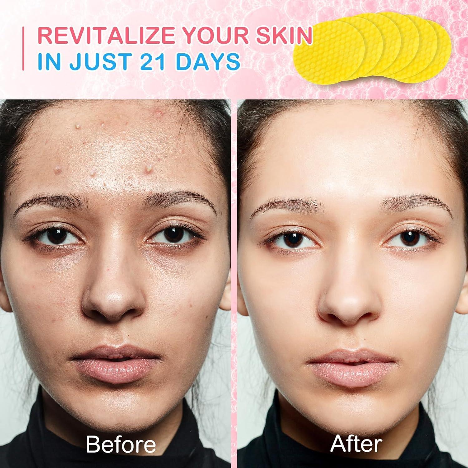 Discos Limpiadores de Cúrcuma ELBBUB - 40 Unidades para Cuidado Facial